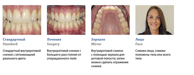 EyeSpecial15.jpg EyeSpecial15.jpg