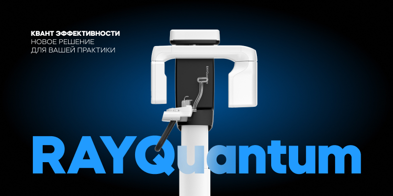 RAY Quantum 10×10 дентальный томограф Frame 1.jpg